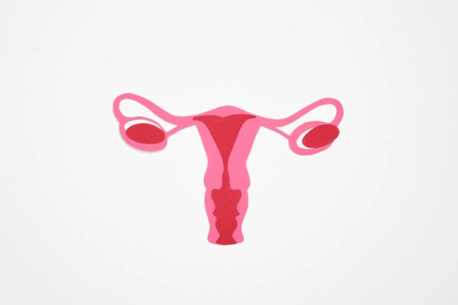 Sintomas de mioma uterino